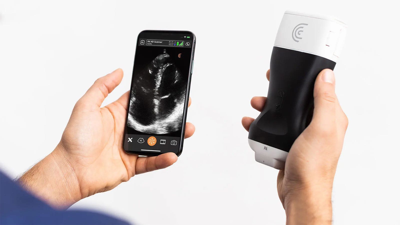 Should I Get a Handheld Ultrasound?